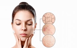 איך כדאי לדאוג לטיפוח עור הפנים בחורף? קרדיט תמונה FREEPIK