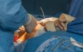 כמה עולה ניתוח הקטנת חזה ? כל המידע והדרכים להוזיל! הקטנת חזה